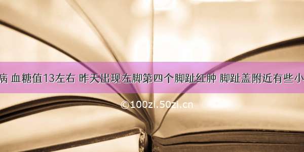 二型糖尿病 血糖值13左右 昨天出现左脚第四个脚趾红肿 脚趾盖附近有些小白点 好像