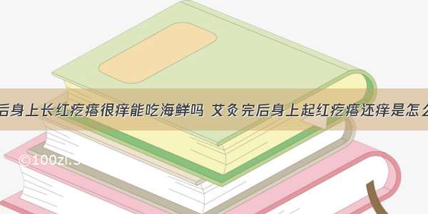 艾灸后身上长红疙瘩很痒能吃海鲜吗 艾灸完后身上起红疙瘩还痒是怎么回事