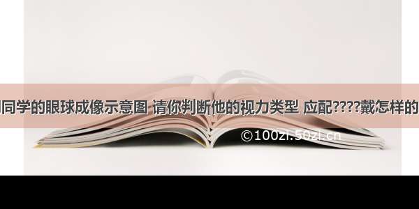 如图是小明同学的眼球成像示意图 请你判断他的视力类型 应配????戴怎样的眼镜矫正A.